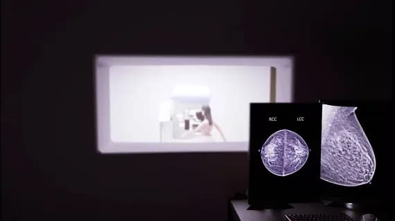 New AI Flags Uncertainty in Breast Cancer Imaging Predictions