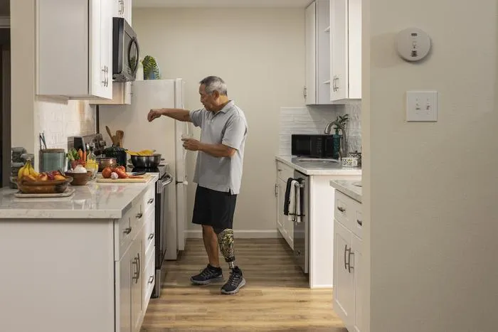 AI Accelerates DSX Imaging for Improved Prosthetic Limb Fitting