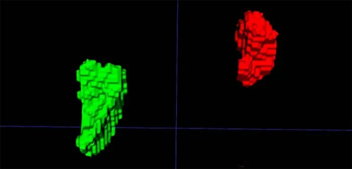 AI-Based Imaging Biomarker for Chronic Stress Validated on Chest CT