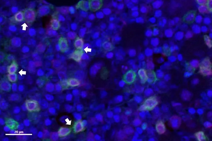 AI-Driven Bone Marrow Mapping Tool Improves Blood Cancer Assessment