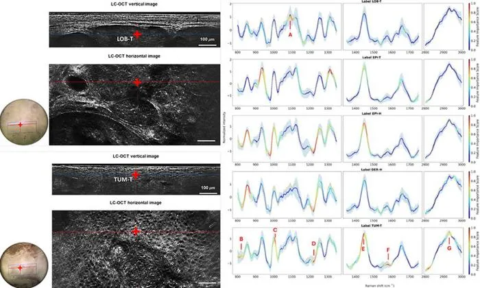 AI-Enhanced Dual-Mode Imaging Boosts Noninvasive Skin Cancer Diagnosis