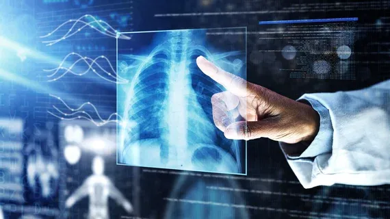 AI-Generated Report Summaries Improve Patient Understanding at Emory Radiology