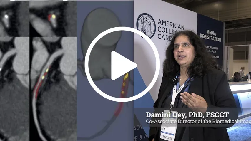 AI Is Quietly Embedded in Cardiac Imaging Workflows
