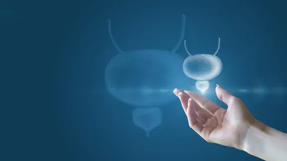 AI Model Personalizes RPT Doses for Prostate Cancer in Seconds