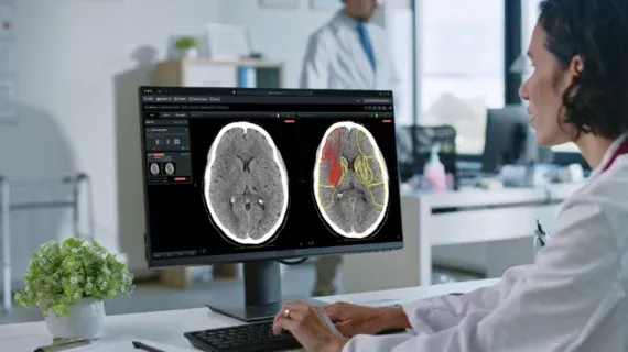 AI brain platform triples UK stroke patient independence