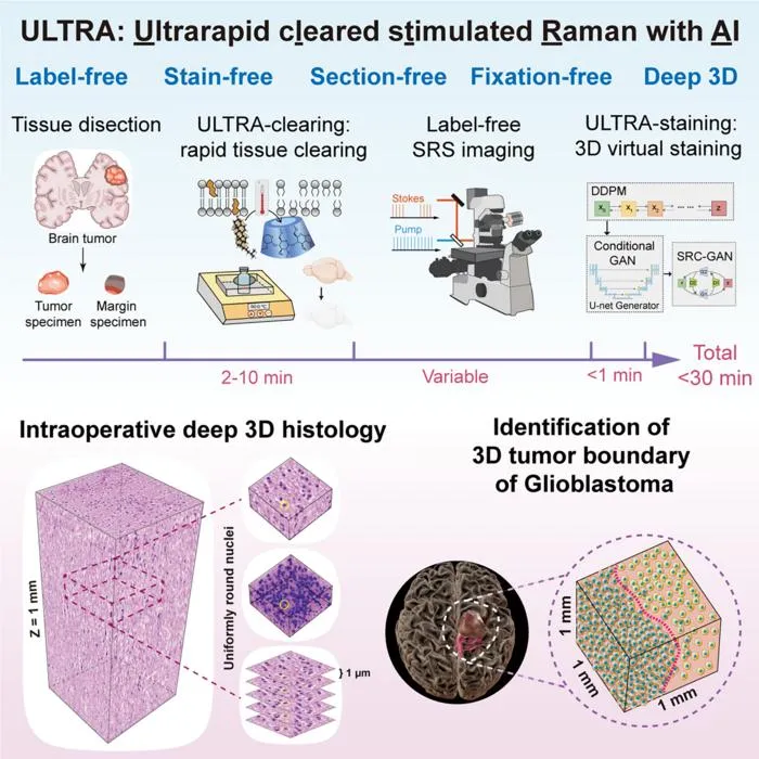 AI-Powered 3D Intraoperative Imaging Transforms Glioma Surgery