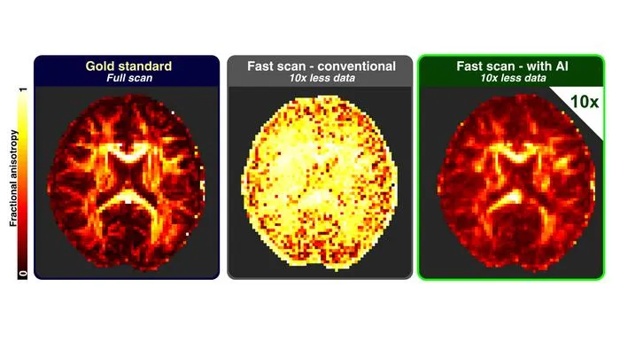 AI-Simulation Approach Achieves 90% Faster Brain MRI with Minimal Data