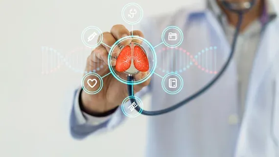 AI Surpasses Radiologists in Predicting Lung Cancer Treatment Response