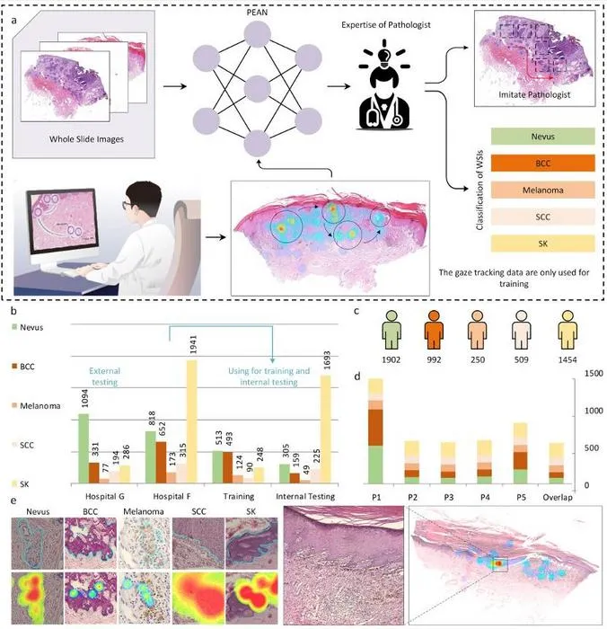 New AI Model Learns Diagnostic Skill from Pathologists' Eyes