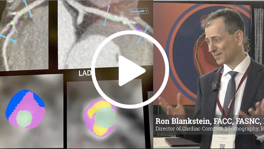 Best Practices for Integrating AI Into Cardiac Imaging Workflows