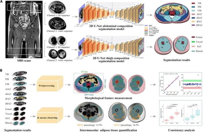 BioCompNet AI Automates MRI Body Composition Analysis for Cardiometabolic Risk