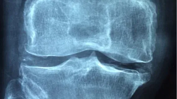 Carebot Unveils LLM-Powered Assistant for MSK X-ray Reporting