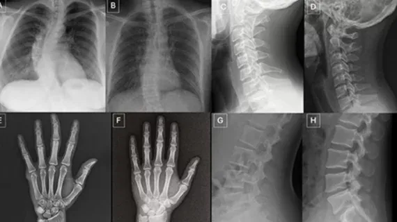 Deepfake X-rays Fool Radiologists and AI, Raising Security Concerns