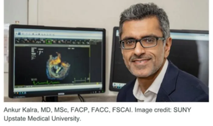 Explainable AI Predicts High-Risk Heart Attack Patients for Imaging and Treatment