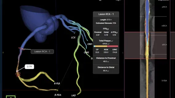 FDA Clears Elucid's AI-Driven FFR-CT Solution for Cardiac Imaging
