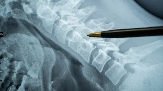FDA Clears MRI2CT AI for 3D Bone Visualization from MRI