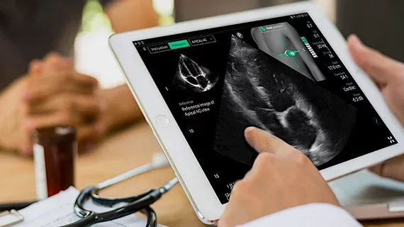 FDA Expands Clearance for AI-Guided Echo Exams on Existing Ultrasound Systems