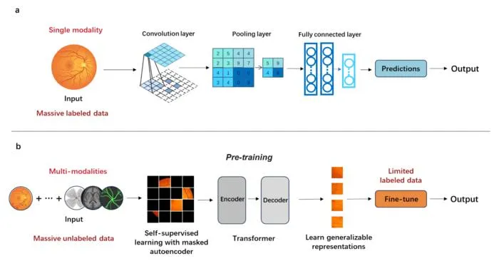 Foundation Models Advance Ophthalmic Imaging AI: Review Highlights Milestones and Challenges