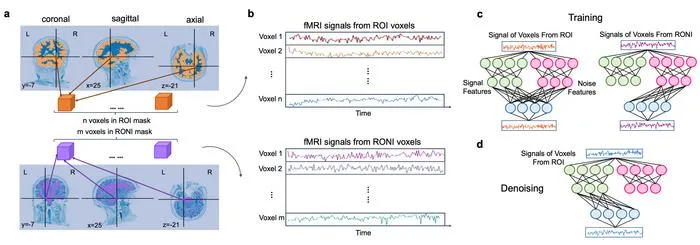 Generative AI Significantly Improves Denoising of fMRI Brain Data