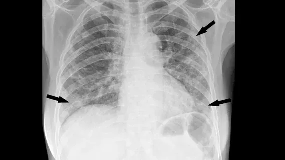 Imaging AI Systems Could Play Key Role in Future Pandemic Response