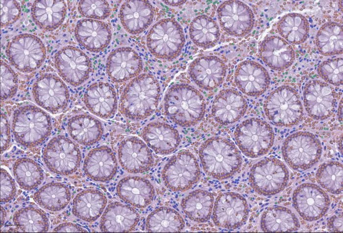 LazySlide: Open-Source AI Tool Advances Digital Pathology Analysis