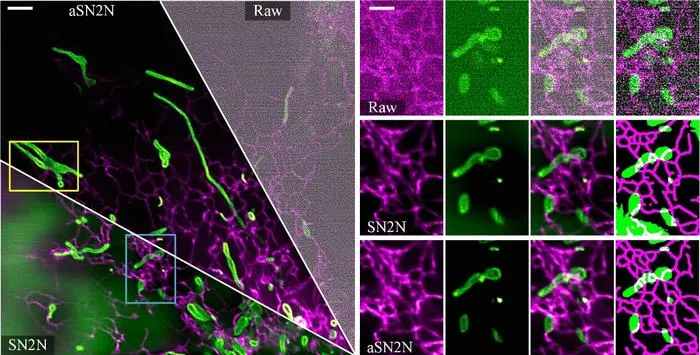 New AI Method Removes Artifacts in Super-Resolution Fluorescence Microscopy