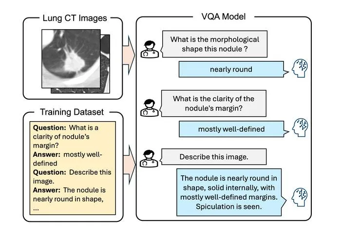 New AI Vision-Language Model Enhances Chest CT Diagnostics