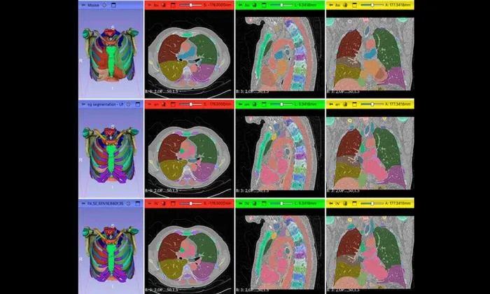 New Framework Compares AI Segmentation Without Ground Truth Annotations
