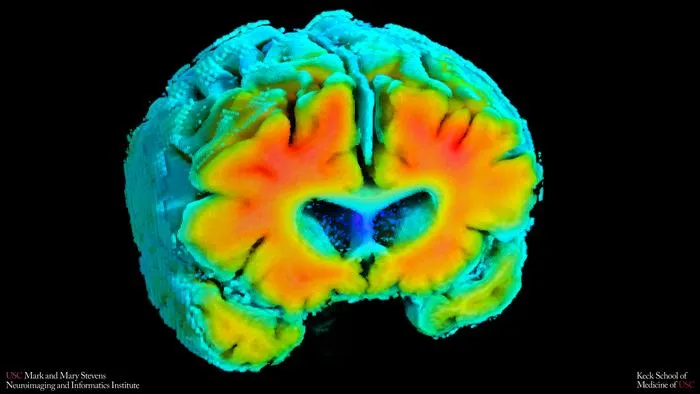 Noninvasive Brain Blood Flow Markers Linked to Early Alzheimer’s Risk