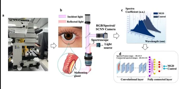 Optical AI Chip Boosts Real-Time Dry Eye Gland Diagnosis Accuracy