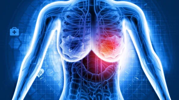 Patient Perceptions of AI in Mammography Differ Across Healthcare Settings