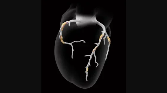 Preparing for Major Changes in CCTA and AI Imaging Reimbursement