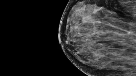Prognosia Breast AI Earns FDA Breakthrough Designation for Cancer Risk Prediction
