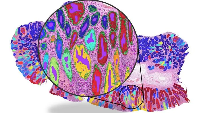 Study Exposes 'Shortcut Learning' Risks in AI Cancer Pathology Models