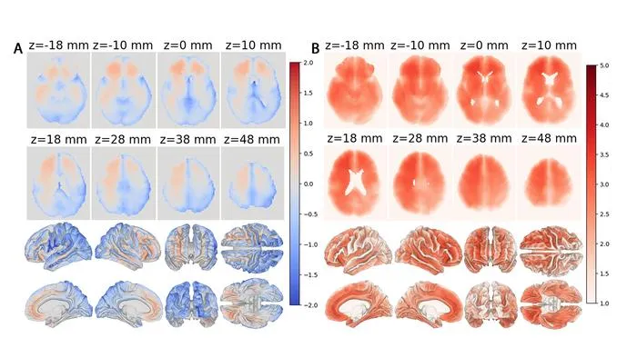 USC AI Model Maps Local Brain Aging on MRI to Aid Dementia Research