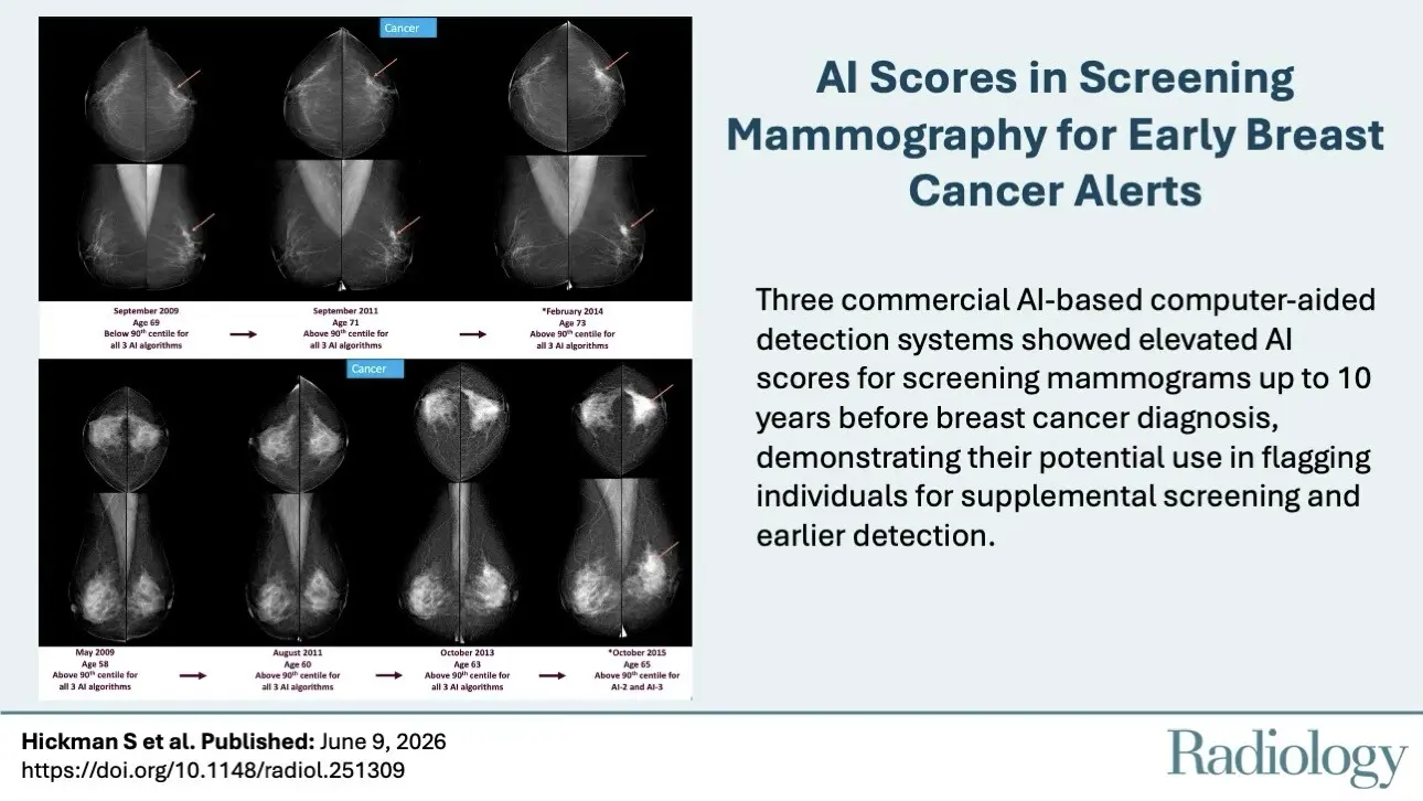 🩻 AI flagged 19.7% of cancers 6 years early