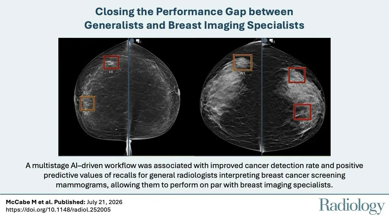 🩻 AI lifts CDR to 4.99 per 1000 DBT exams