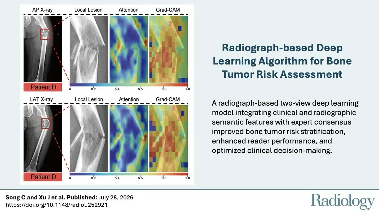 Bone tumor AI reaches AUC 0.99 in prospective testing