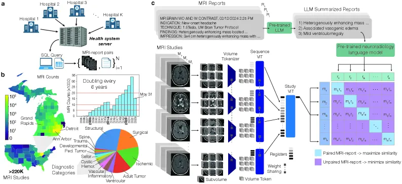 Brain MRI AI achieves 97.5% accuracy across 52 diagnoses