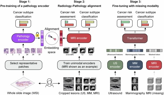 Breast AI targets biopsy decisions across 27,048 patients