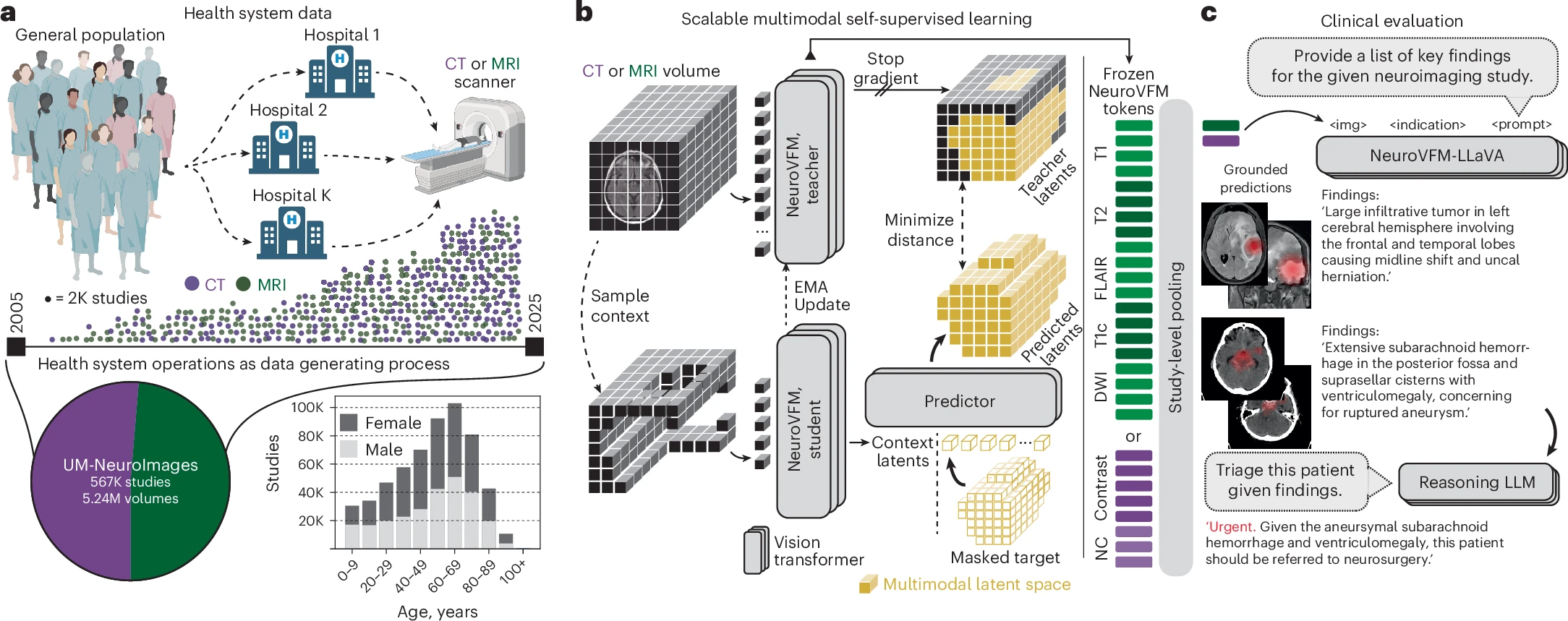Neuro AI trained on 5.24M MRI and CT volumes
