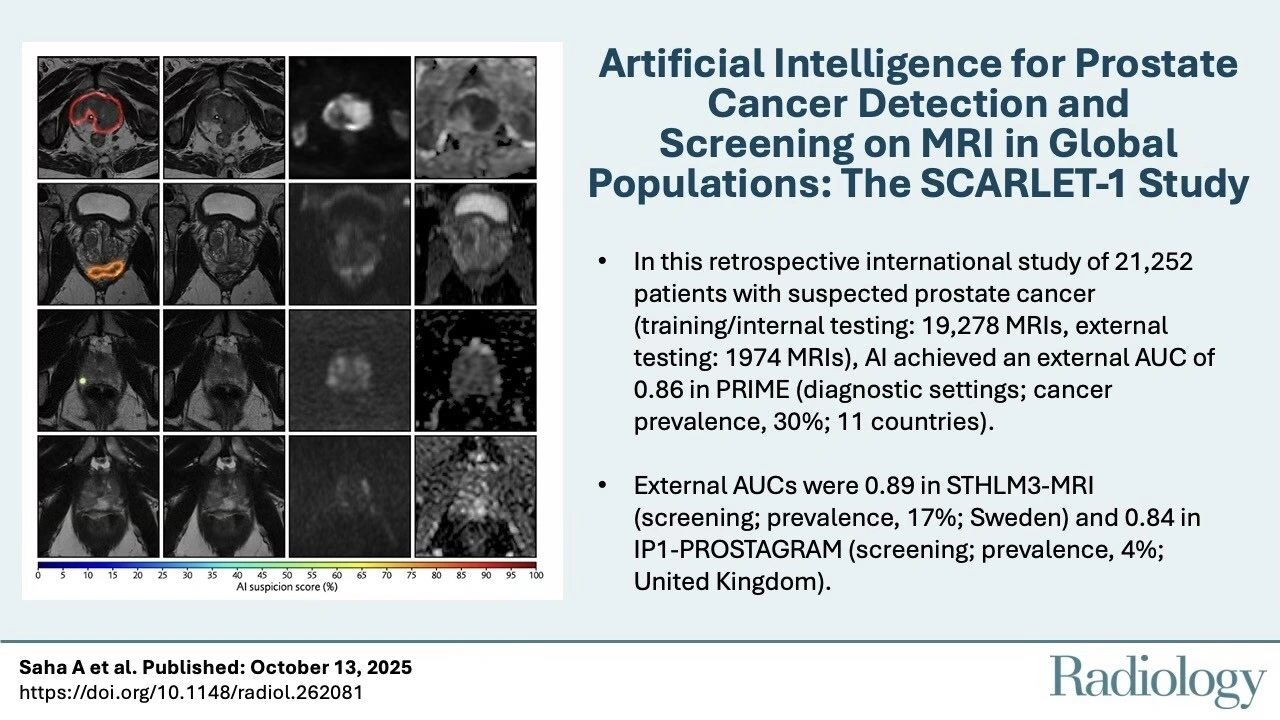 Prostate MRI AI tested in 22,445 exams